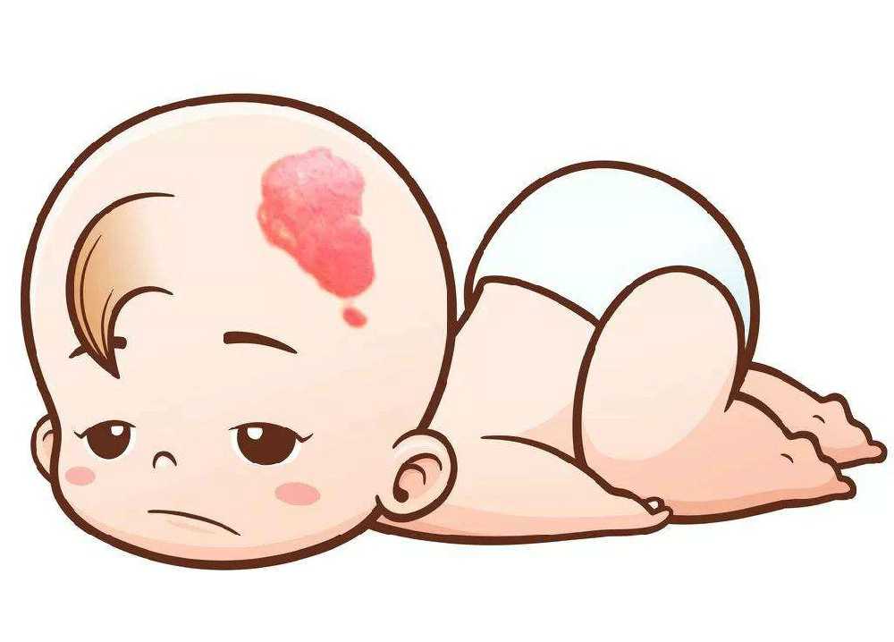 对红胎记的错误概念有哪些? 对红胎记的错误概念有哪些?