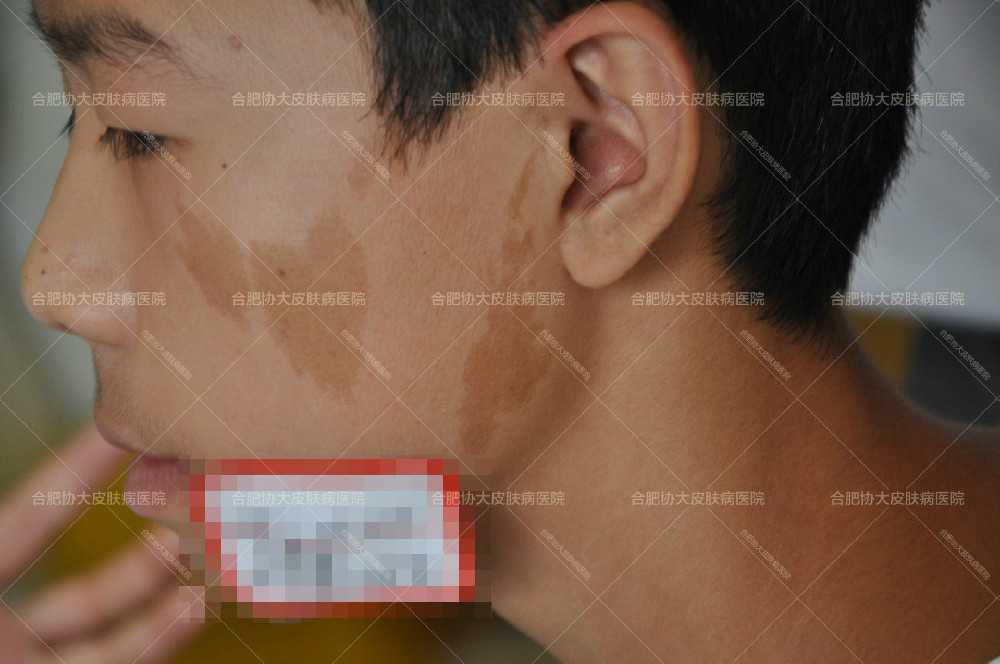 1659658387544596.jpg 1.jpg